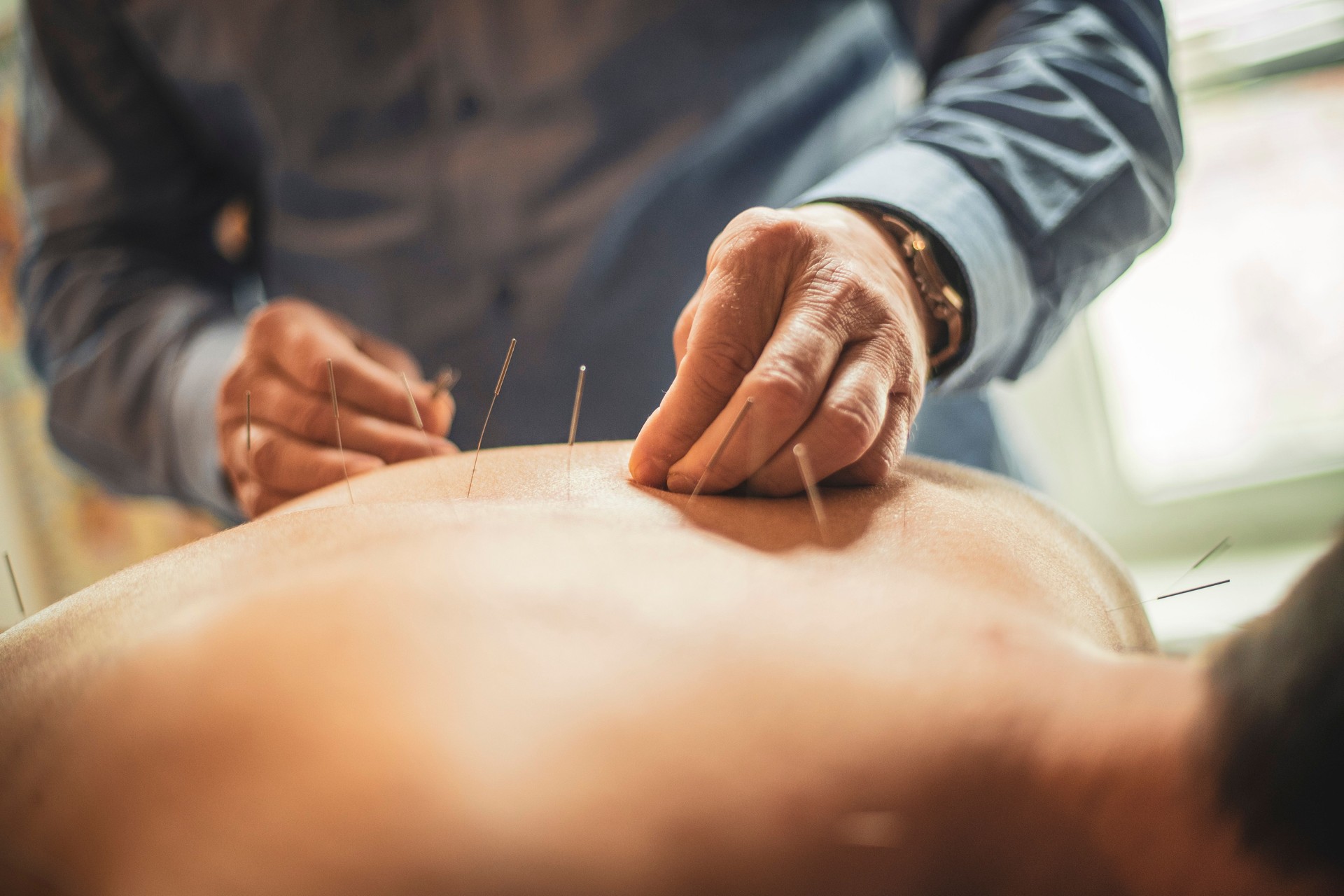 Receiving acupuncture therapy