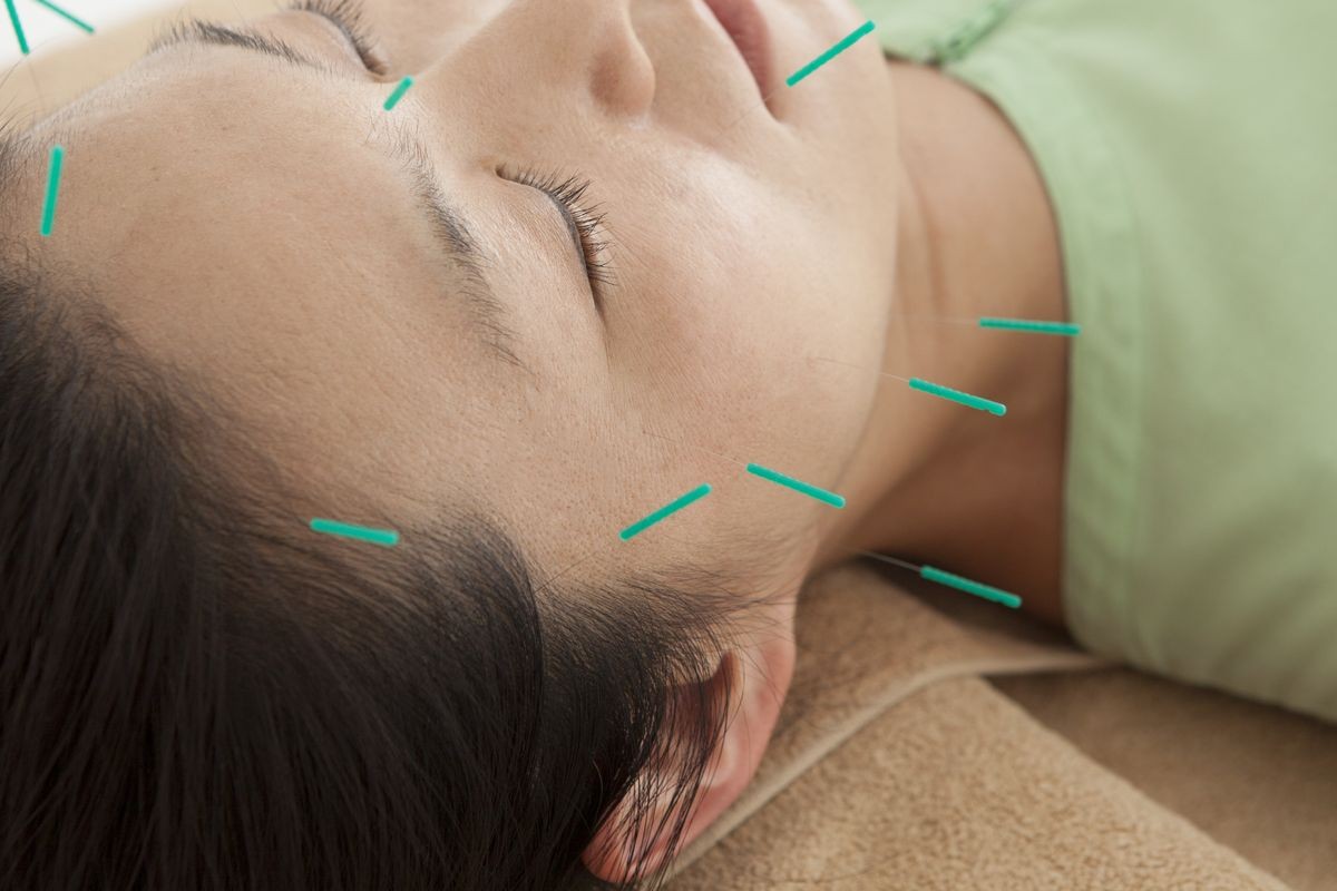 Women who get acupuncture to rejuvenated